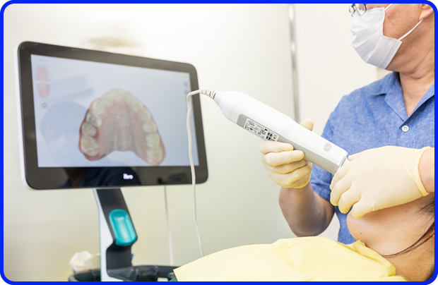 口腔内スキャナーで患者さまの負担が少なく正確な歯型を採取できます。